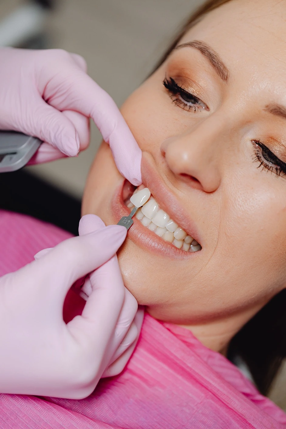 Clear aligners orthodontic treatment at Golden Crown Dental Surgery Lahore