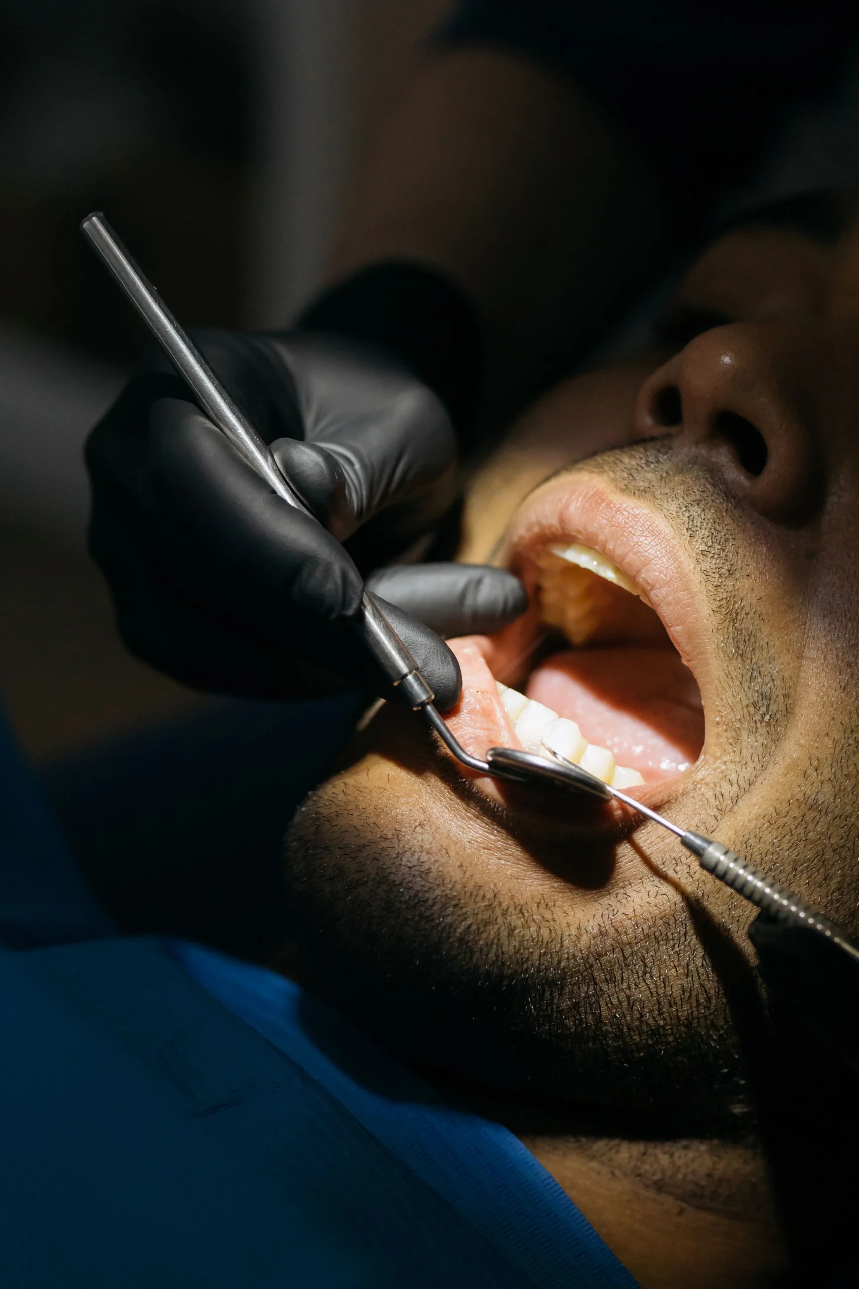 Restoring normal function after root canal