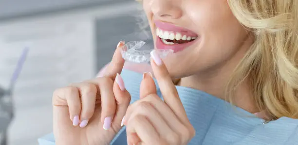 Clear aligners vs braces comparison at Golden Crown Dental Surgery