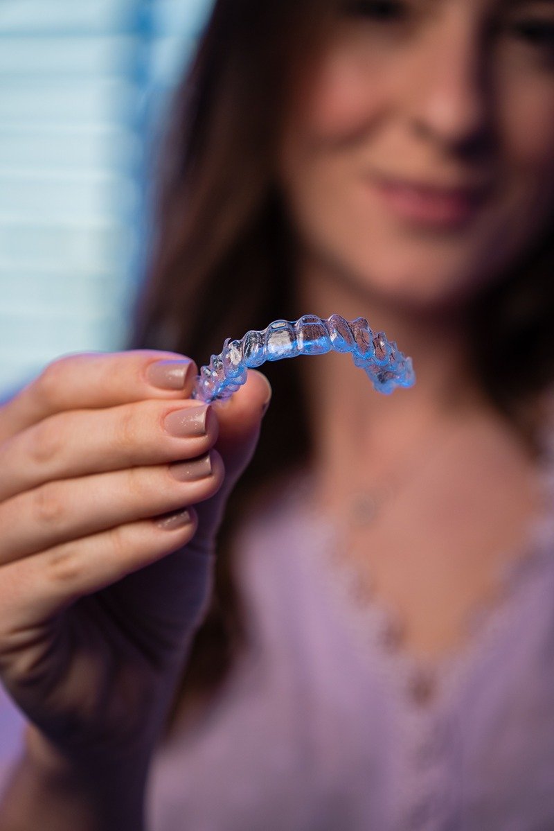 Removable clear aligners - take out for eating and cleaning