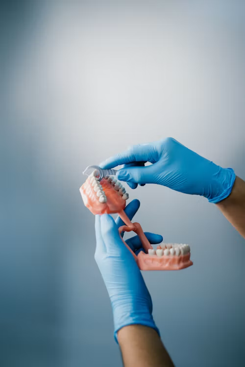 Aesthetic clear aligners treatment - invisible braces