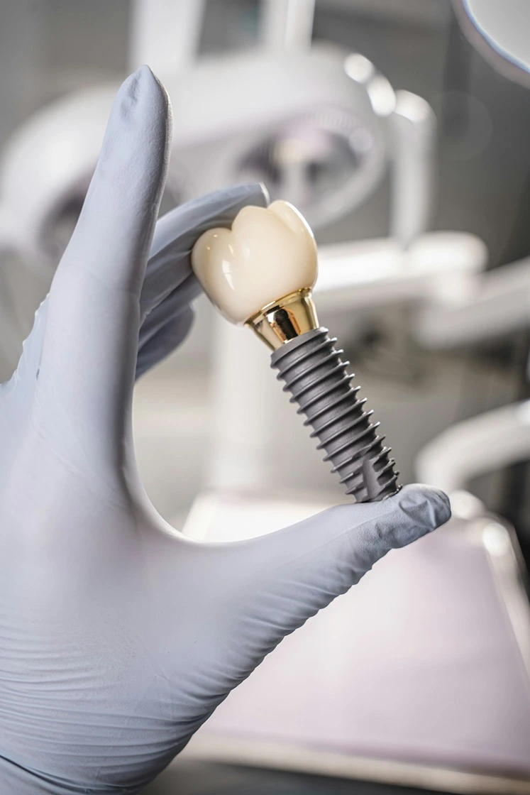 Root canal treatment at Golden Crown