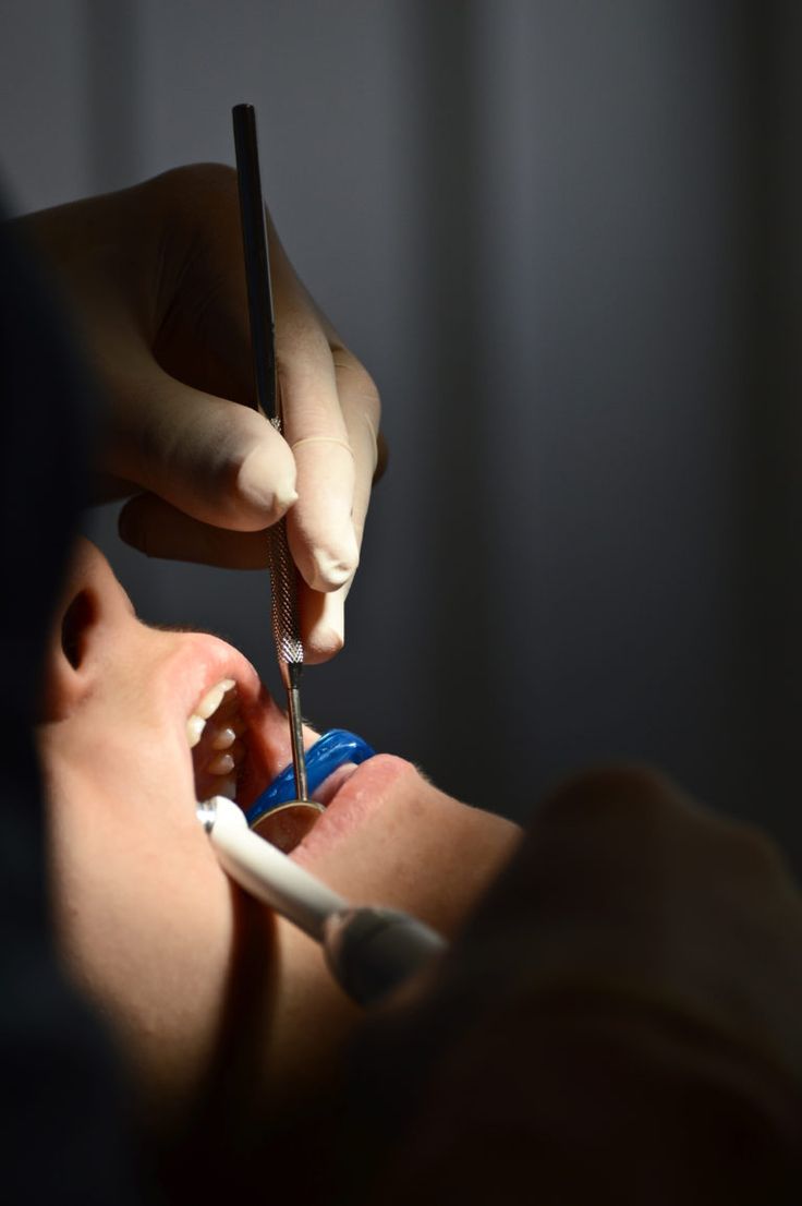 Best teeth scaling treatment in Lahore Pakistan at Golden Crown Dental Surgery
