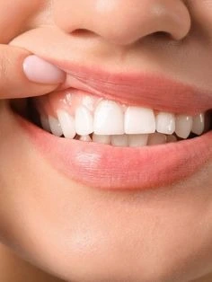 Healthy gums treatment periodontist Lahore