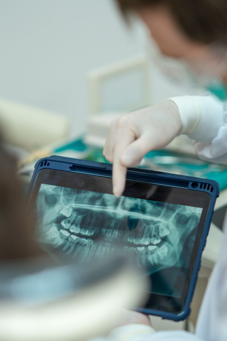 Painless ultrasonic scaling Pakistan