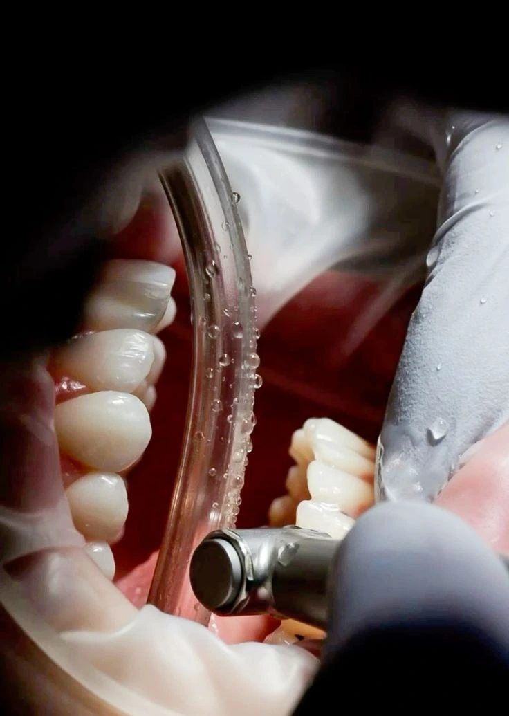 Best periodontist treatment in Lahore Pakistan at Golden Crown Dental Surgery