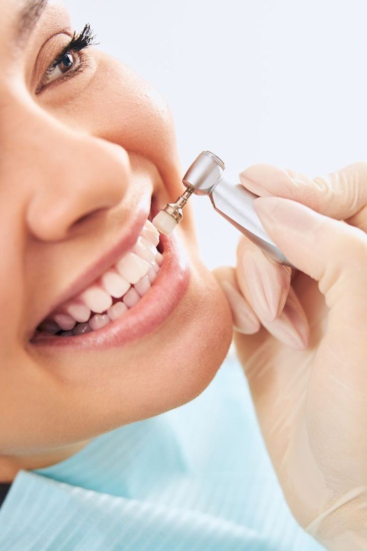Expert teeth scaling dental cleaning Lahore Pakistan Golden Crown Dental Surgery