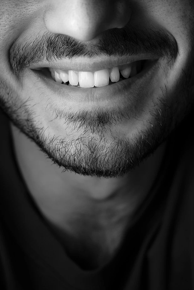 Healthier gums with teeth scaling treatment