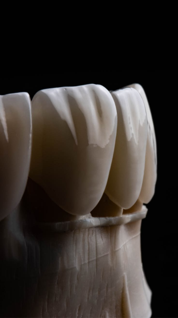 Protection and strengthening with dental crown