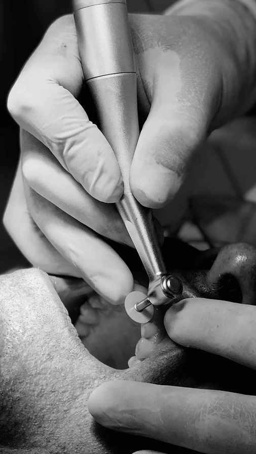 Dental restoration and tooth reconstruction at Golden Crown Dental Surgery Lahore